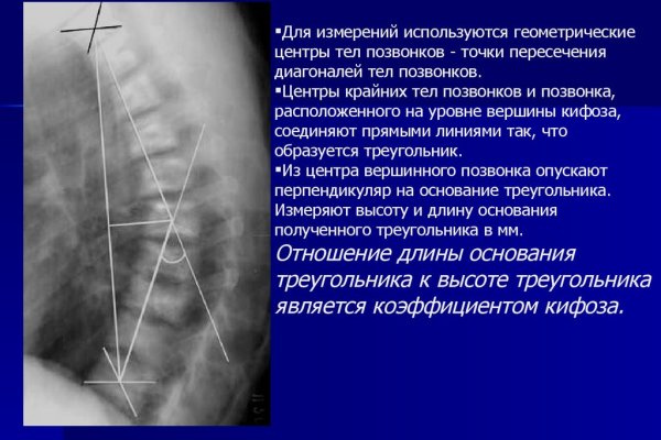 Ссылки тор браузер